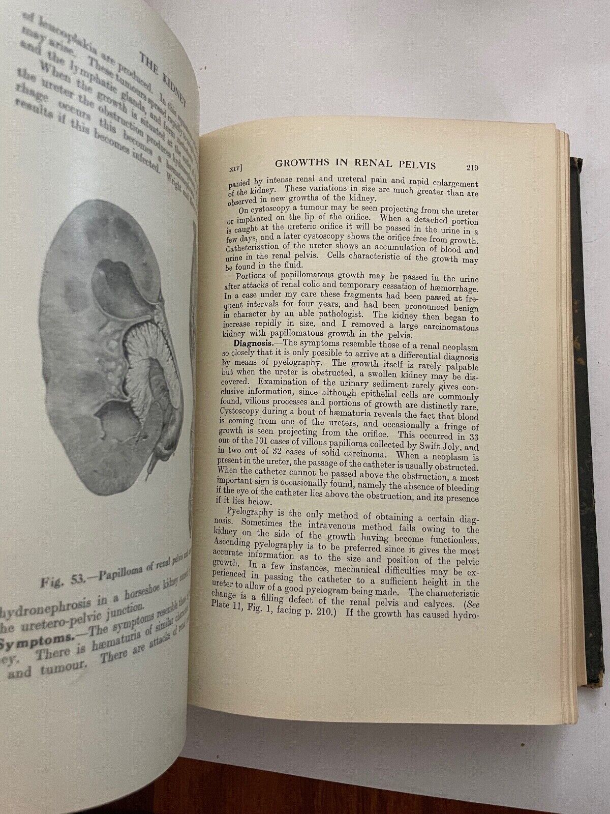 Surgical Diseases and Injuries of the Genito-Urinary Organs by John Thomson-Walk