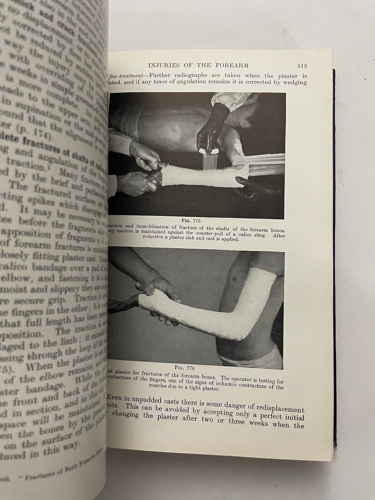 Fractures and Joint Injuries by Reginald Watson-Jones