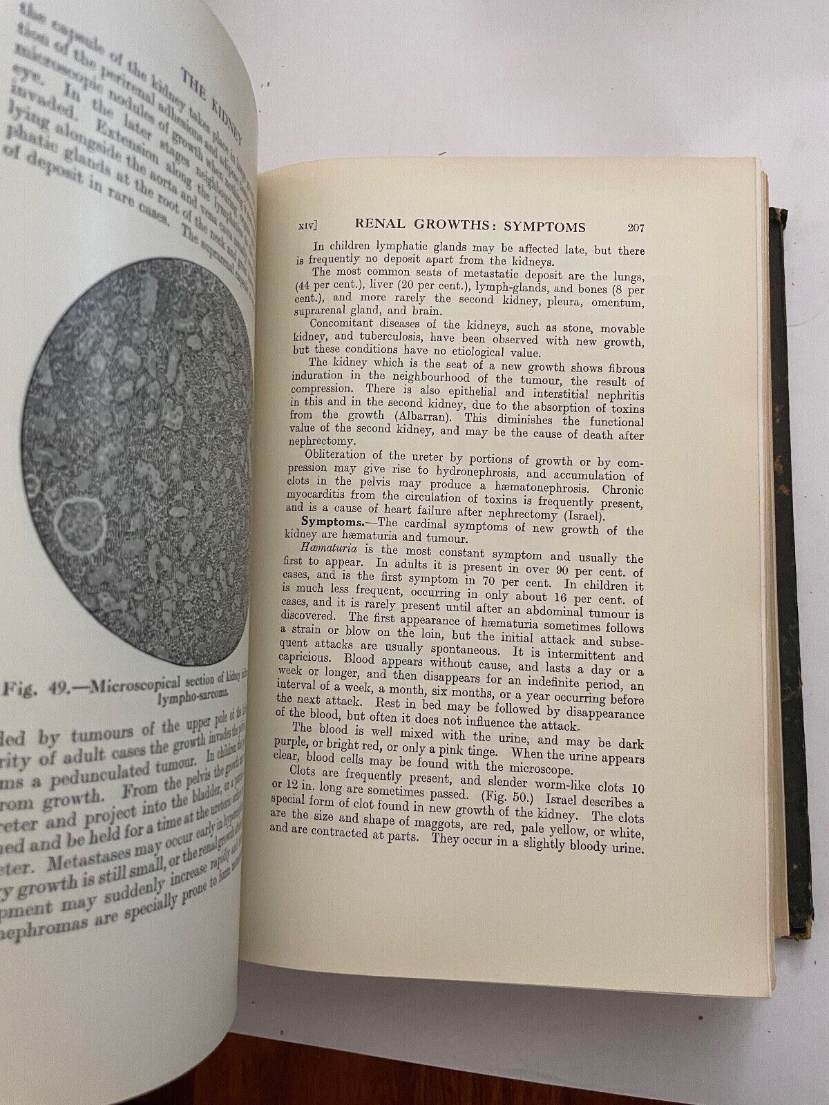 Surgical Diseases and Injuries of the Genito-Urinary Organs by John Thomson-Walk