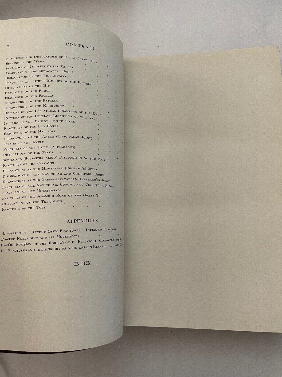 The treatment of Fractures by Lorenz Bohler