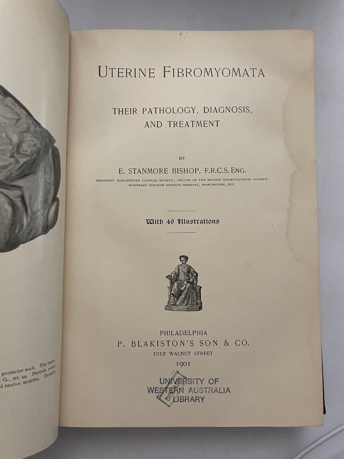 Uterine Fibromyomata; Their Pathology, Diagnosis and Treatment 1901
