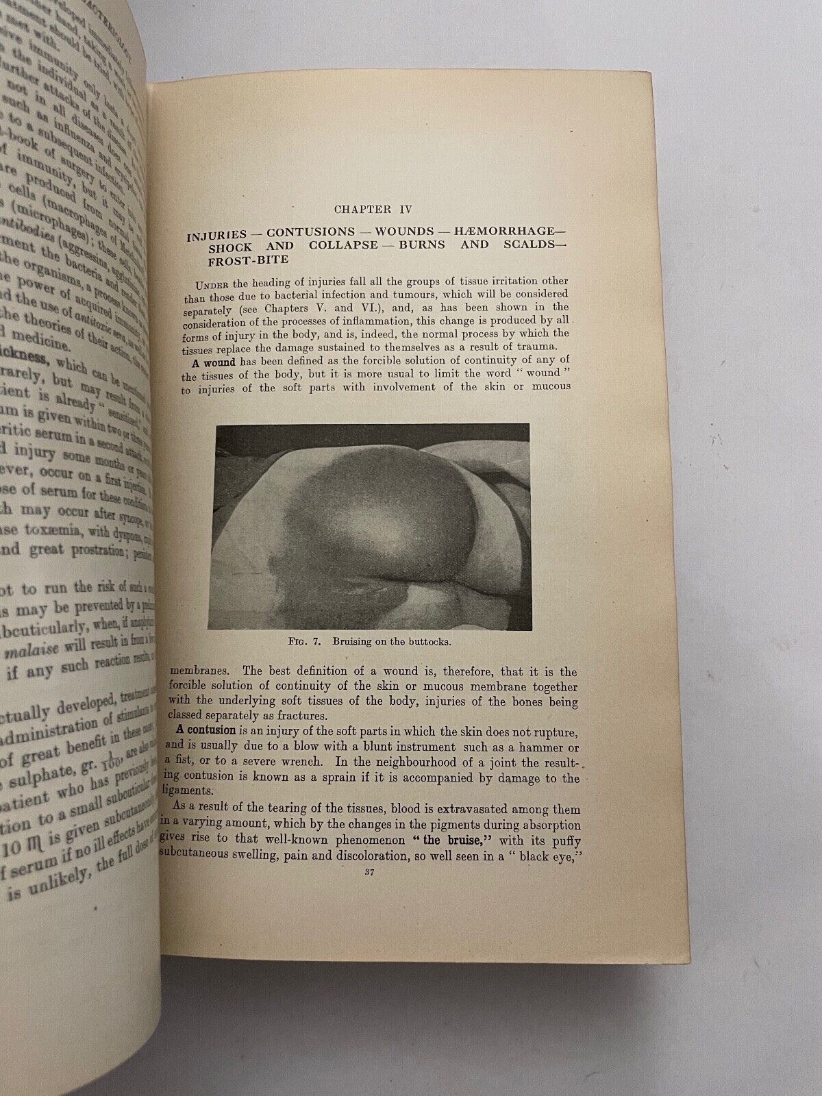The Science and Practice of Surgery by Romain and Mitchiner 1941