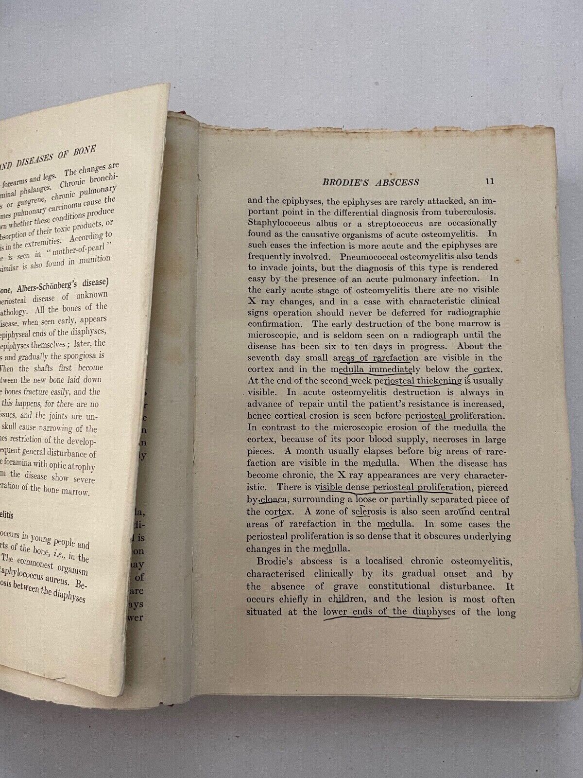 Recent Advances in Radiology Kerley