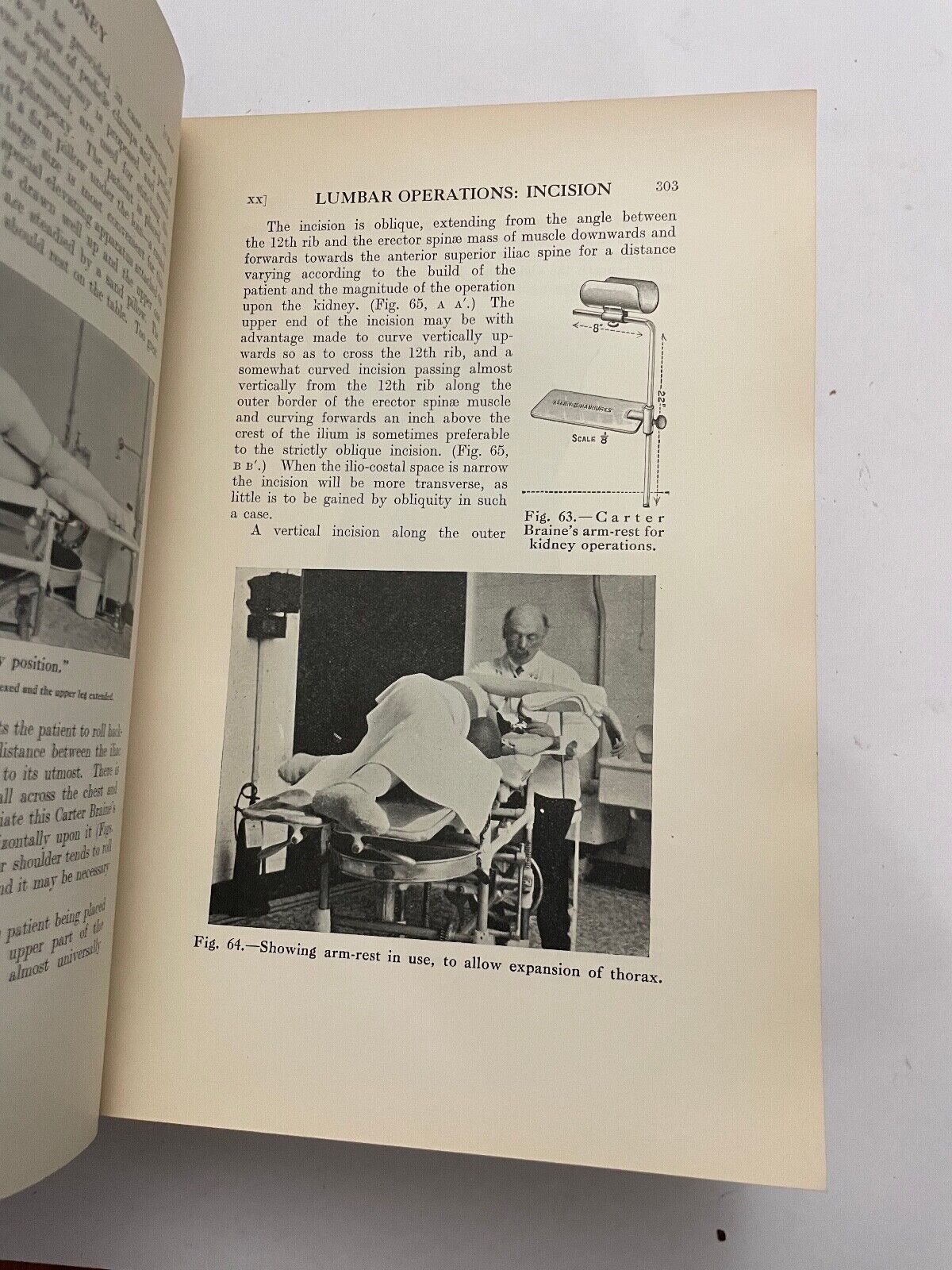 Surgical Diseases and Injuries of the Genito-Urinary Organs by J Thomson-Walker