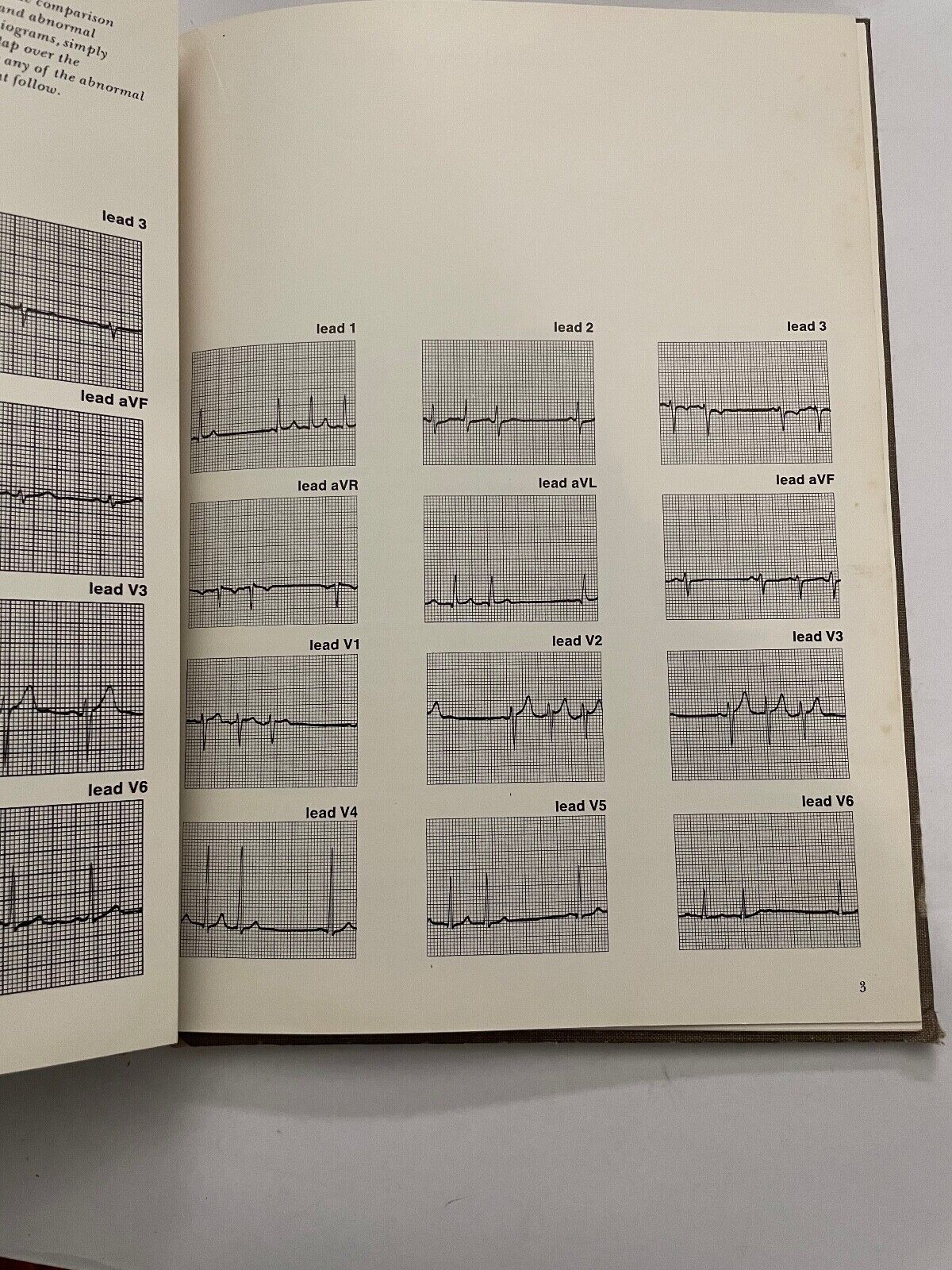 Egg Interpretation 1962 by M.D. John Bernard Schwedel