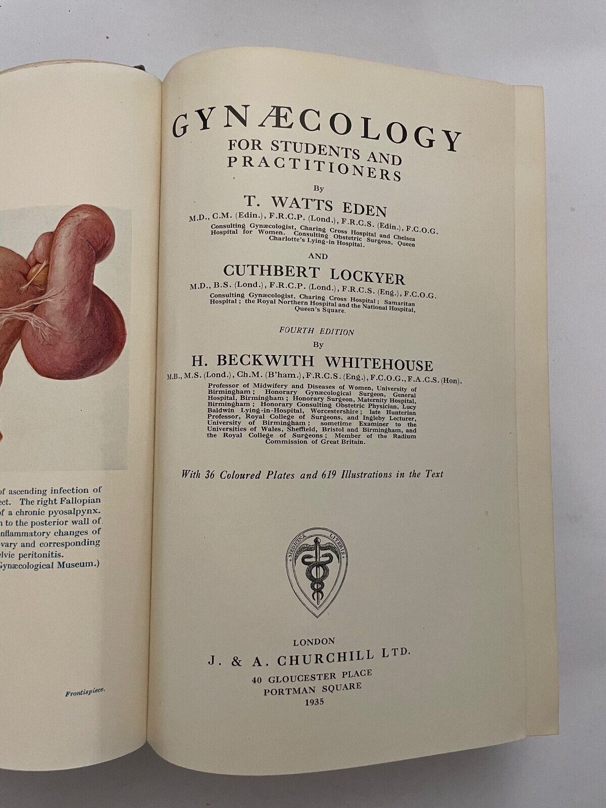 Eden and Lockyer's Gynaecology by Beckwith and Whitehouse