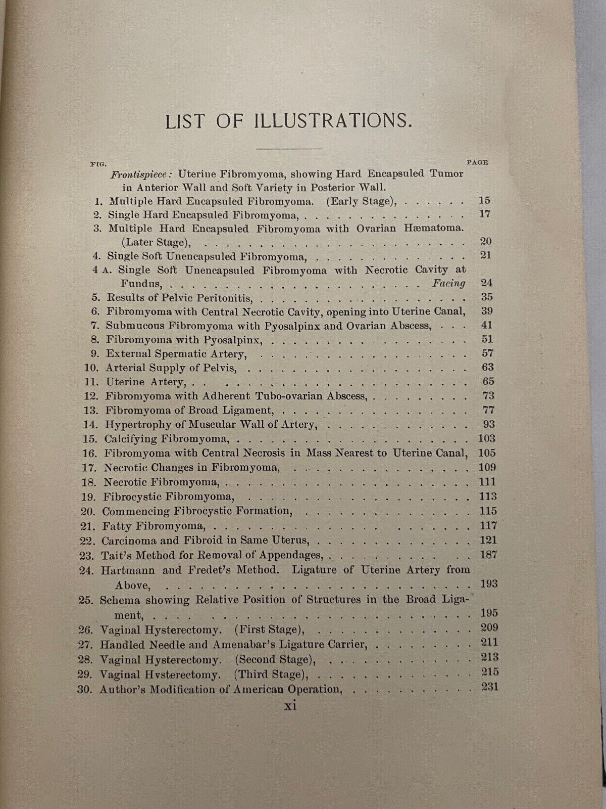 Uterine Fibromyomata; Their Pathology, Diagnosis and Treatment 1901