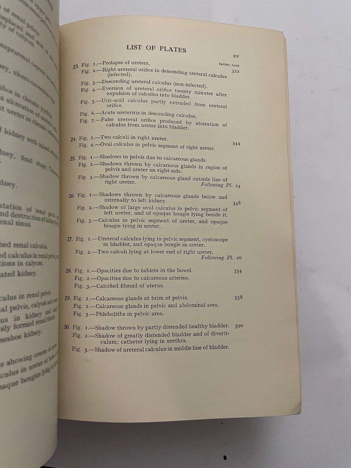 Surgical Diseases and Injuries of the Genito-Urinary Organs by J Thomson-Walker