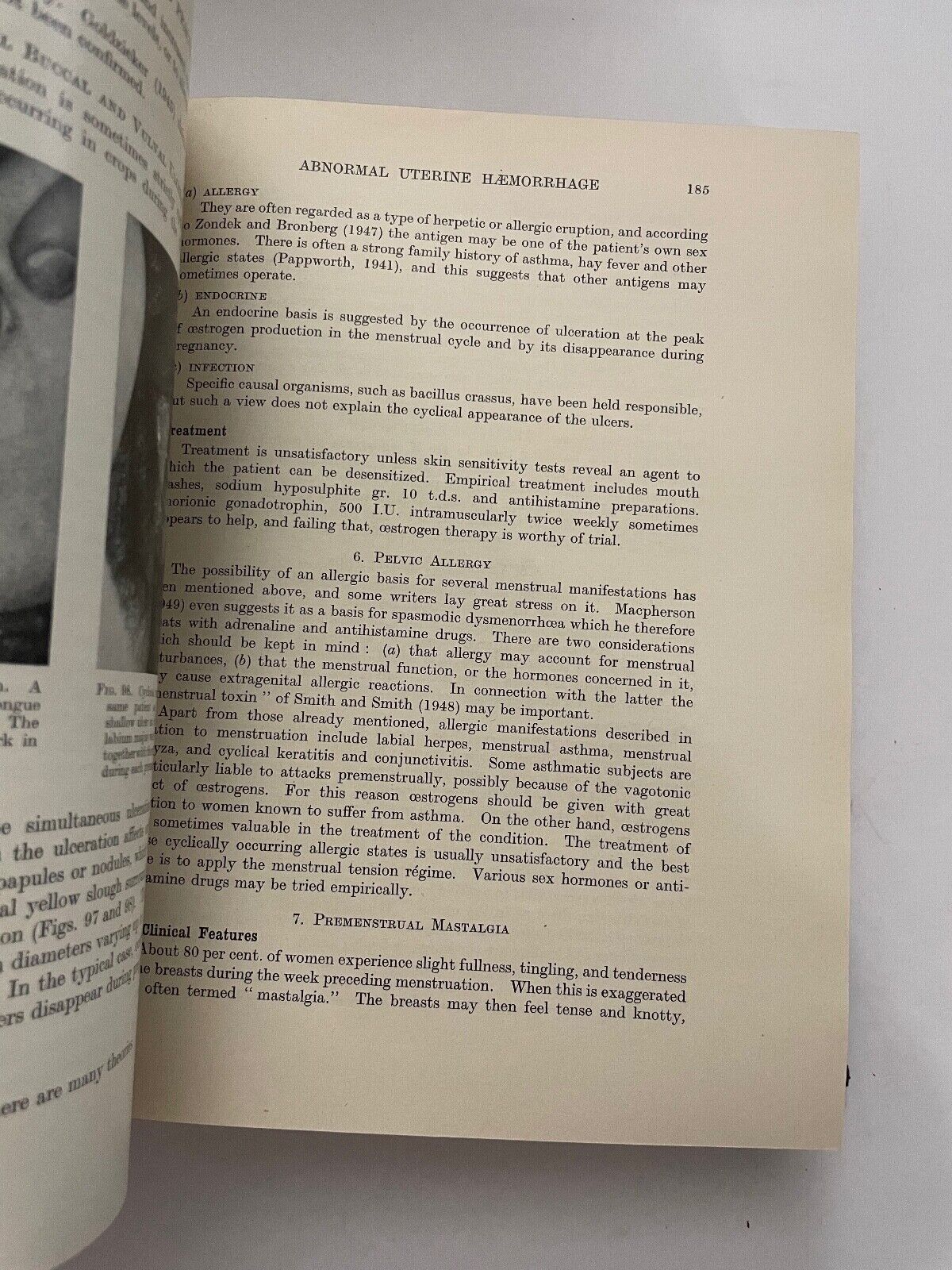 British Obstetric and Gynaecological Practice by Eardley Holland